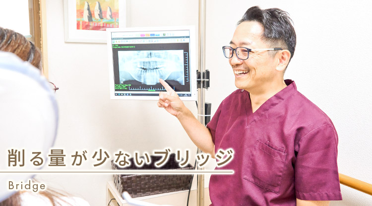 福山市で「削らない接着性ブリッジ」｜よしだ歯科